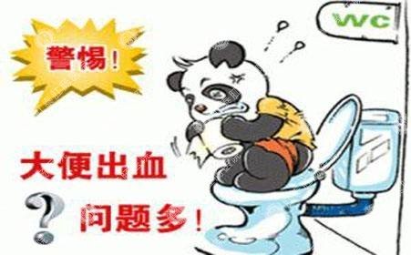 福州治疗外痔的费用是多少